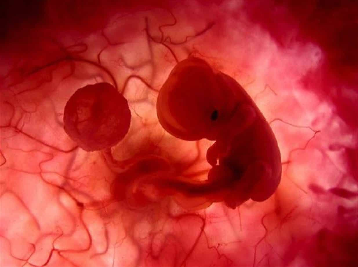 كيف يكون شكل الجنين المجهض في الشهر الثاني